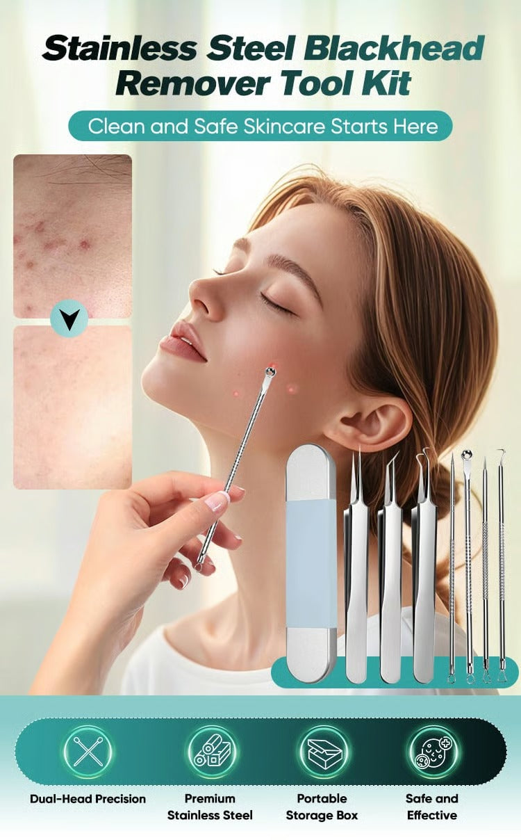Professional facial blackhead remover tweezers