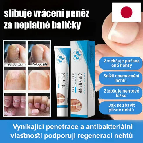 Nail treatment cream 🚚Cash on delivery